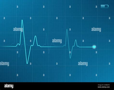 Ilustración del electrocardiograma en color azul con icono de batería