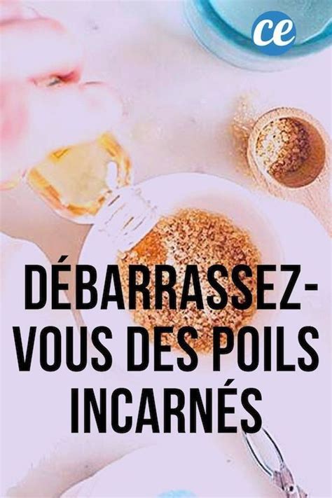 Astuces Efficaces Pour Liminer Les Poils Incarn S En Poil