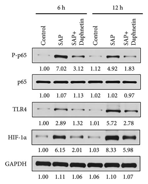 Effects Of Daphnetin On The Protein Expressions Of Tlr4 P Nf κb P65