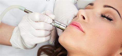 Microdermabrasion - Skin 101 Medical Spa Houston