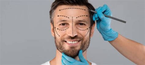 Masculinización facial Ácido hialurónico Hombre Mujer Cirugía