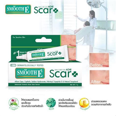 Smooth E Acne Scar Serum 7g