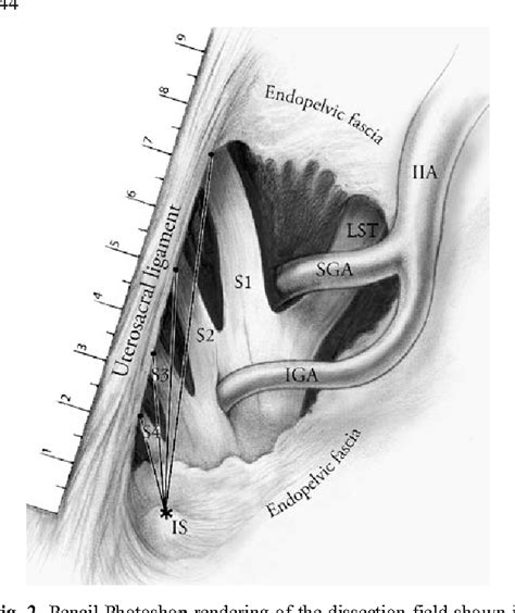 Structure of uterosacral ligament | Semantic Scholar