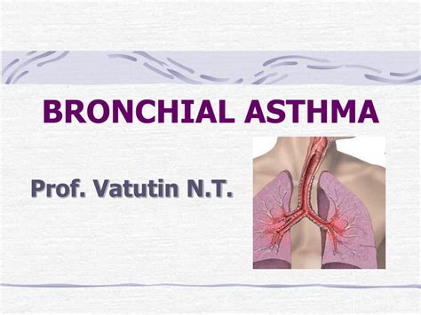 Ppt Bronchial Asthma Powerpoint Presentation Free Download Id 226386