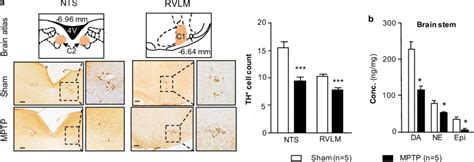 Effects Of MPTP On Noradrenergic Neurons In The Brain Stem