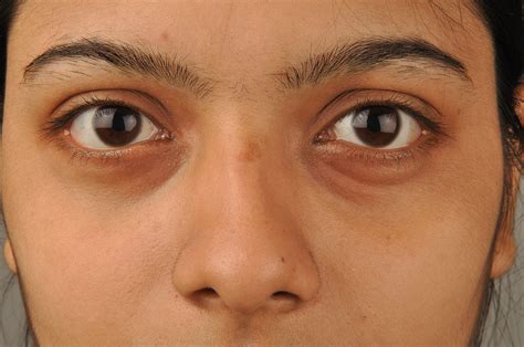 File:Eyes & Nose 5783.JPG - Wikimedia Commons