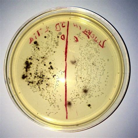 Micrococcus luteus antibiotic treatment