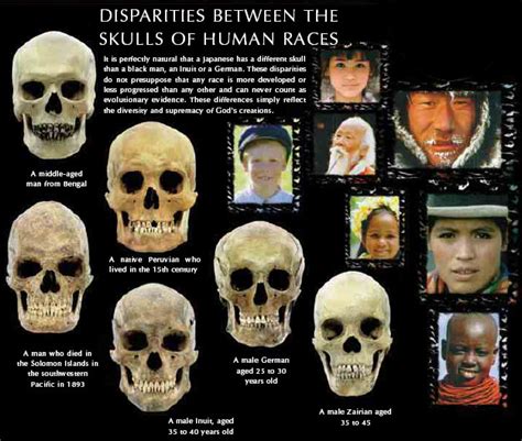 Genesis Jason Hutchings Sex And Racial Skull Variations