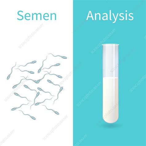 Semen Analysis Illustration Stock Image F Science Photo