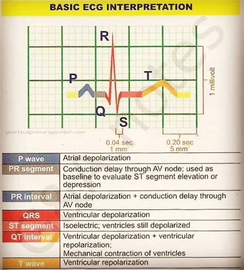 How To Read An Ekg Strip Made Easy How To Do Thing