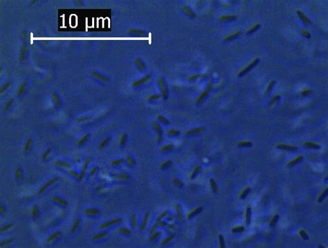 Phase Contrast Microscopic Image Of E Coli Grown Under Normal Condition Download Scientific