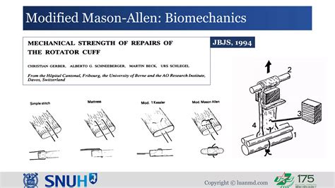 Modified Mason Allen Technique For Rotator Cuff Repair Ppt