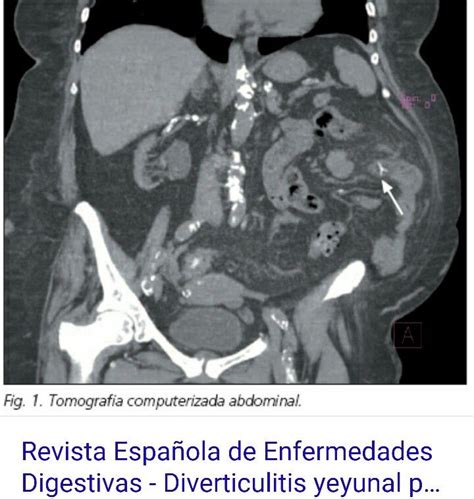 Pin By Liznel Feliberty On Imagenes De Ct Scan Y Mri Ct Scan Movie