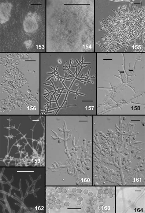 Trichoderma Dorotheae Anamorph From Cmd Conidial Pustules