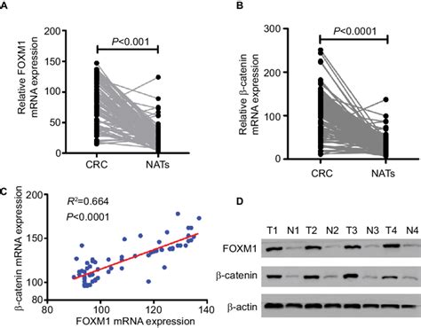 Foxm Mrna Expression Is Upregulated In Human Crc Tissues And