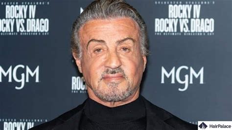 10+ Sylvester Stallone Hair Transplant - UmarKounain