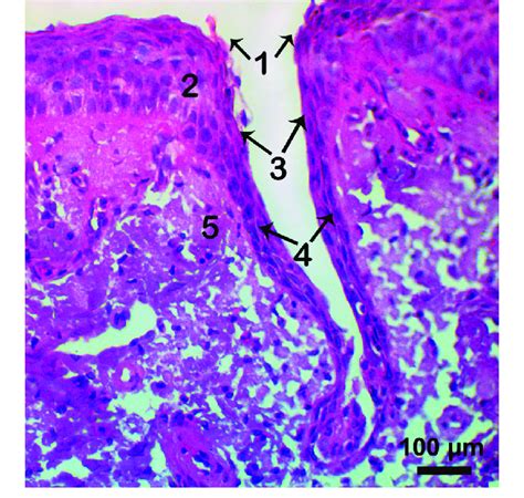 Light Micrograph Showing Sagittal Section In The Nasal Septal Island In