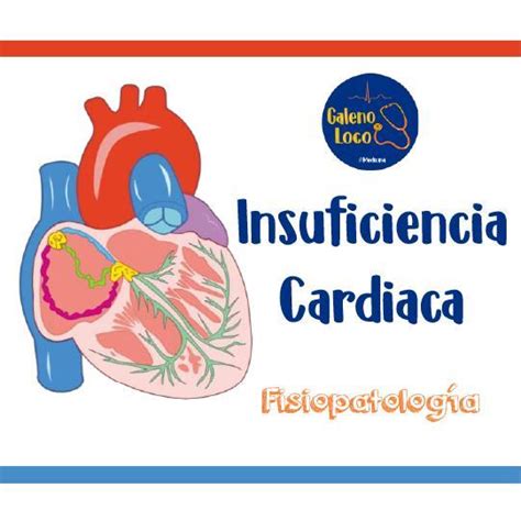 Insuficiencia Cardiaca Fisiopatologia Doc Kenny Udocz