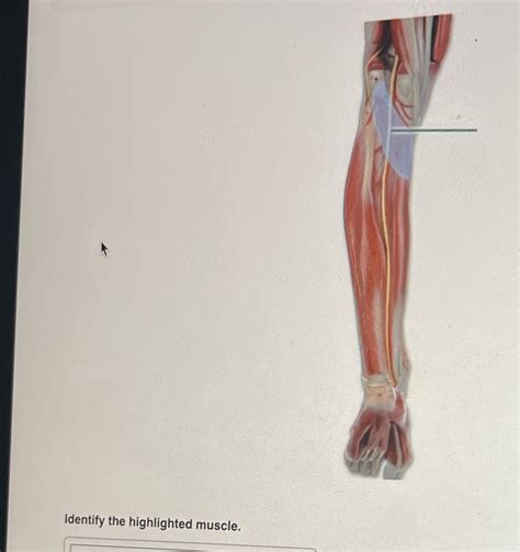 Solved Identify The Highlighted Muscle Course Hero