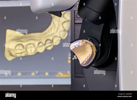 Equipo Cad Cam Escáner Dental De Laboratorio Extraoral Moderno Enfoque Selectivo Fotografía De