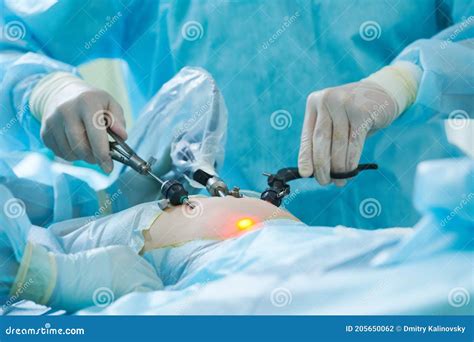 Laparoscopy Doctor S Hands With Laporoscopic Tools During Operation