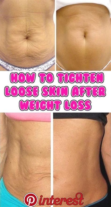 Incredible Ways To Tighten Loose Skin On Thighs References