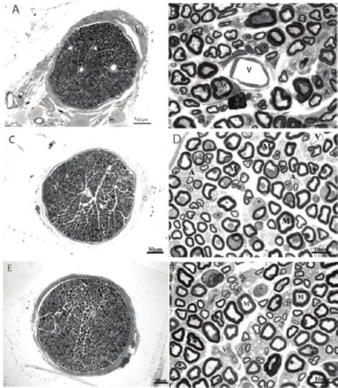 Representative Semithin Cross Section Of The Proximal Segments Of