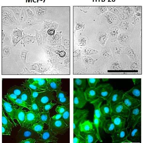 Morphology And F Actin Organization Of Mcf 7 And Mda Mb 231 Breast