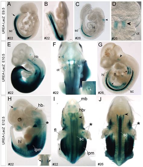 A–J: Whole mount X-gal staining of E9.5 (A–D), E10.5 (E–G) and E12.5 ...