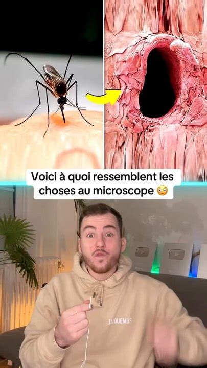 Voici à quoi ressemblent les choses au microscope Vidéo Dailymotion