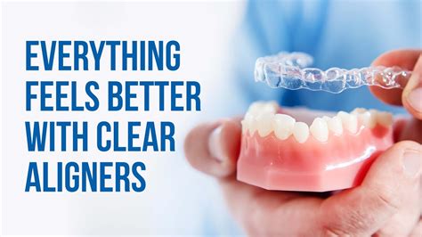 Why Choose Clear Aligners Youtube