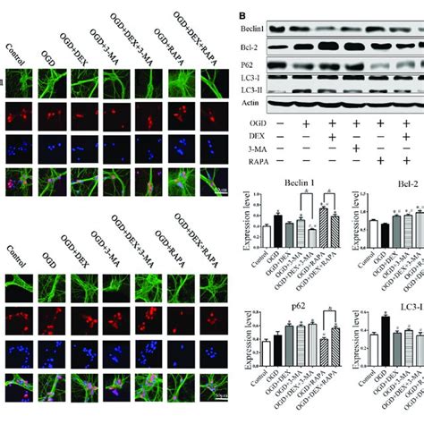 Dex Attenuated Autophagy Of Primary Cultured Cortical Neurons