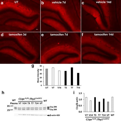 Cell Specific Deletion Of C1qa Identifies Microglia As The Dominant