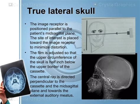 Extraoral Radiography Ppt