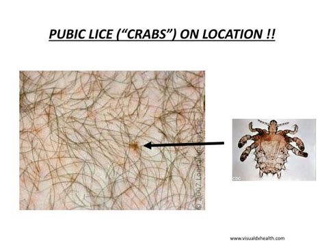 Ppt Microscopy Powerpoint Presentation Id 2620783