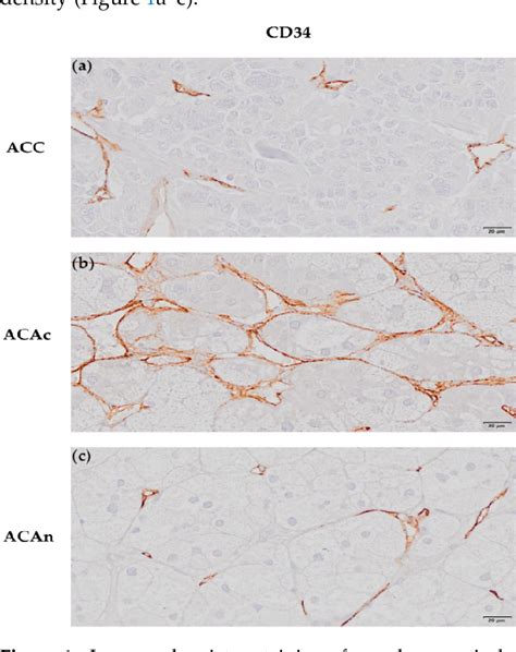 Figure 1 From AngTie Angiogenic Pathway Is Distinctively Expressed In