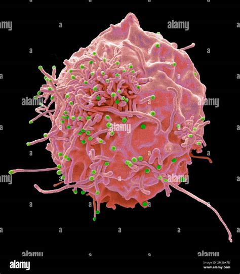 Hiv Scanning Electron Micrograph Sem Of Viral Vectors Based On Hiv