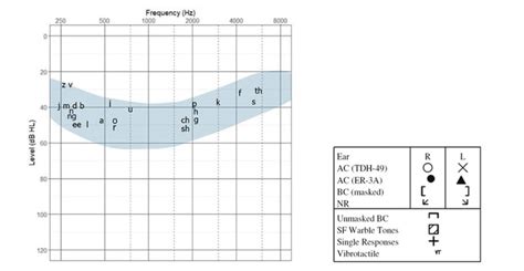 What Is An Audiogram Understanding Hearing Test Results