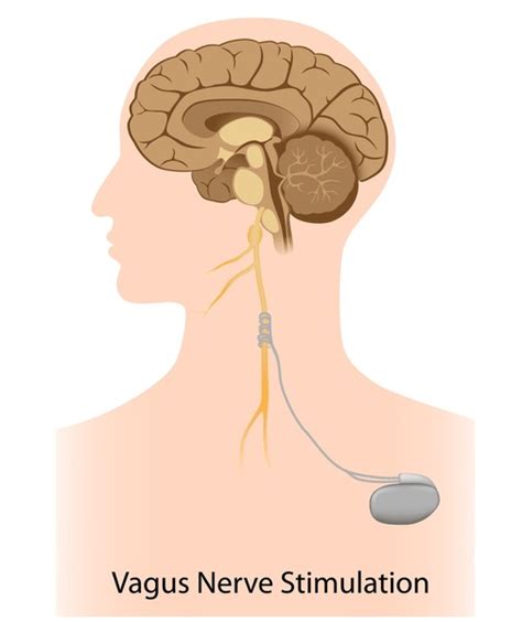 Diagram Stimulate Vagus Nerve Royalty Free Images Stock Photos