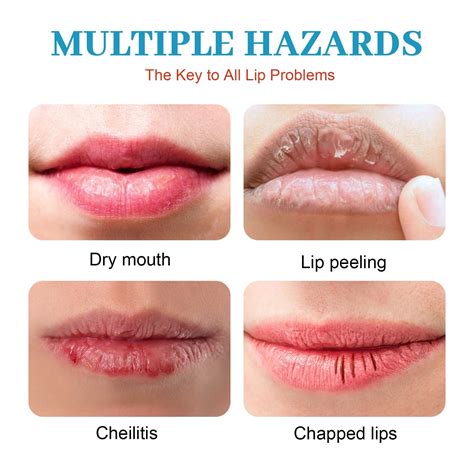 Pandaie Cheilitis Lip Balm Care To Repair Protect Chapped Dry Lips