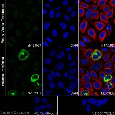 重组Prolactin PRL抗体 EPR19386 ab183967 Abcam中文官网