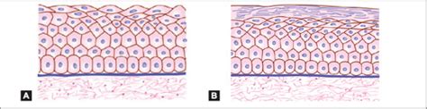 Stratified Squamous Epithelium Keratinized Drawing