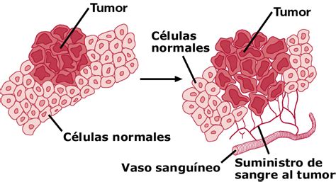 La Neoplasia Escuelapedia Recursos Educativosescuelapedia