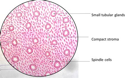 Endometrium: Proliferative phase - Pathology Made Simple