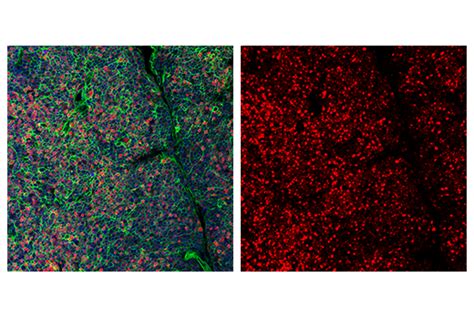 Toxtox2 Antibody E6g5o Alexa Fluor® 647 Conjugate Cell Signaling