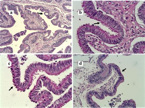 Photomicrography Uterine Tube Panel A Infundibulum Intraepithelial