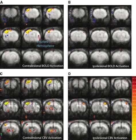 Functional Magnetic Resonance Imaging Activation Maps Of Concatenated