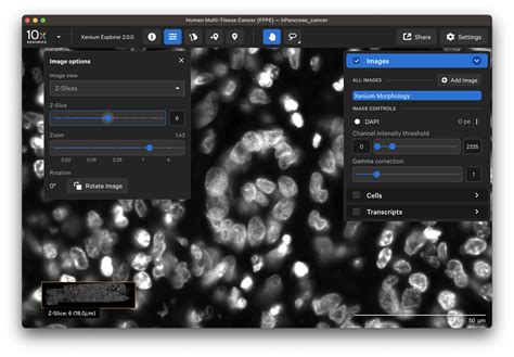 Navigating Xenium Explorer Official 10x Genomics Support