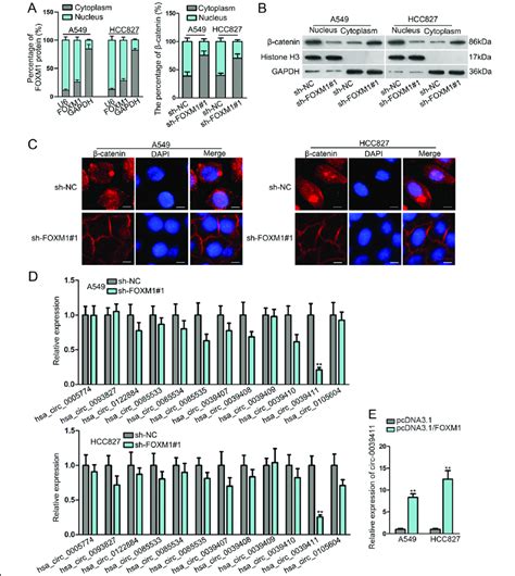 FOXM1 induced β catenin nuclear translocation and circ 0039411 level in