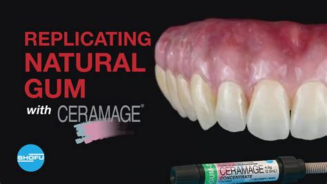 Replicating The Natural Gum With Ceramage Youtube